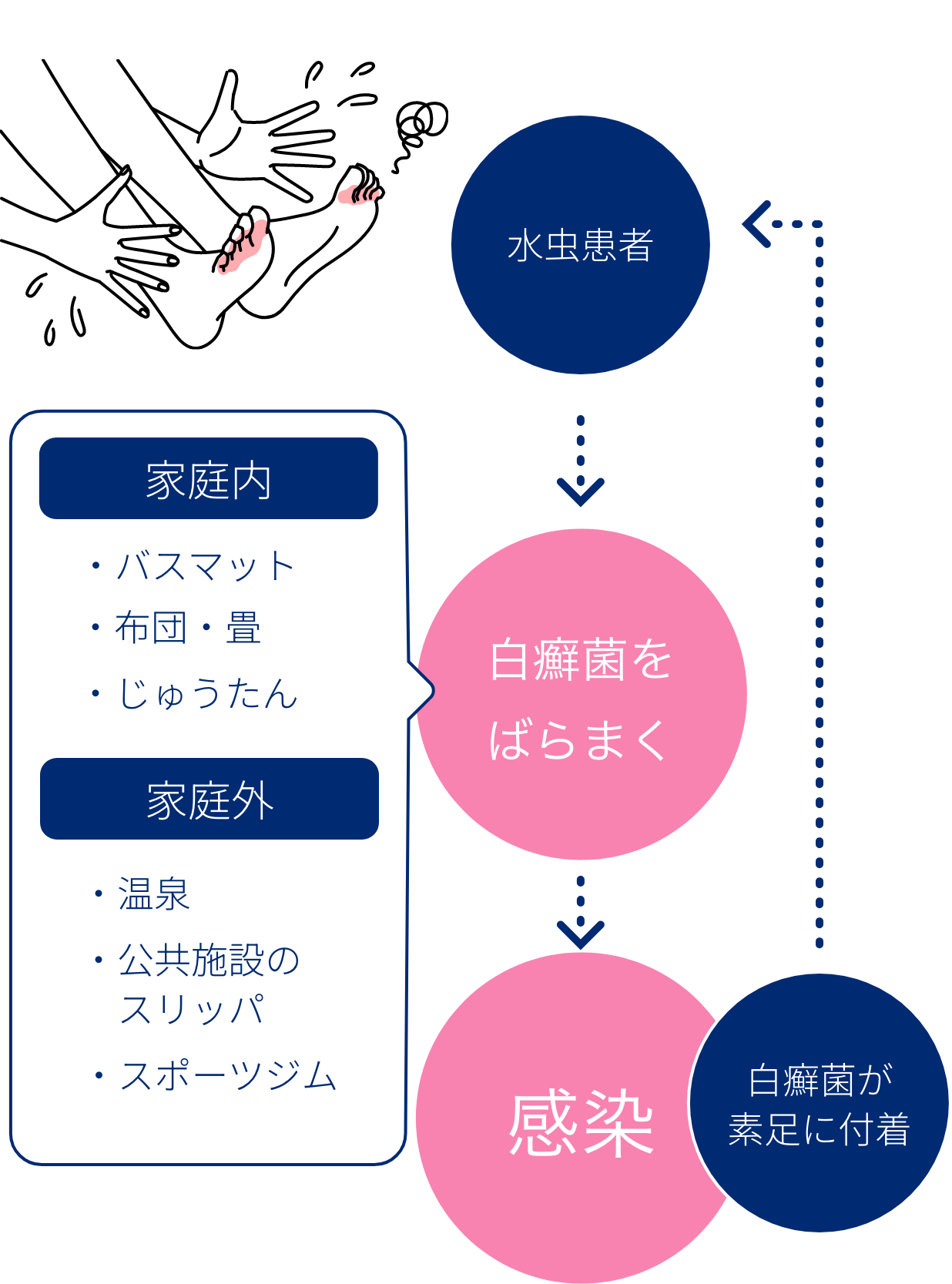 水虫感染経路