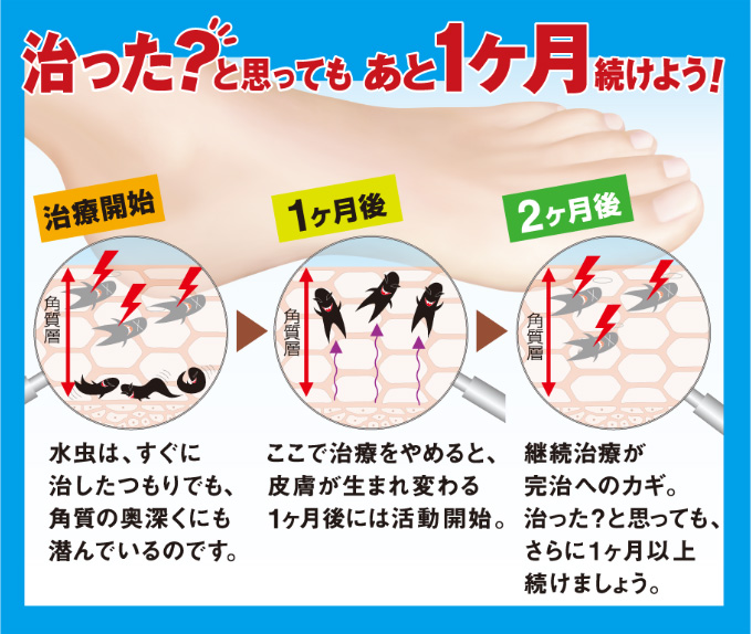 治った？と思っても あと1ヶ月続けよう！