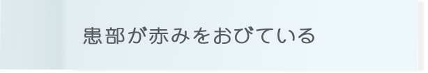 患部が赤みをおびている